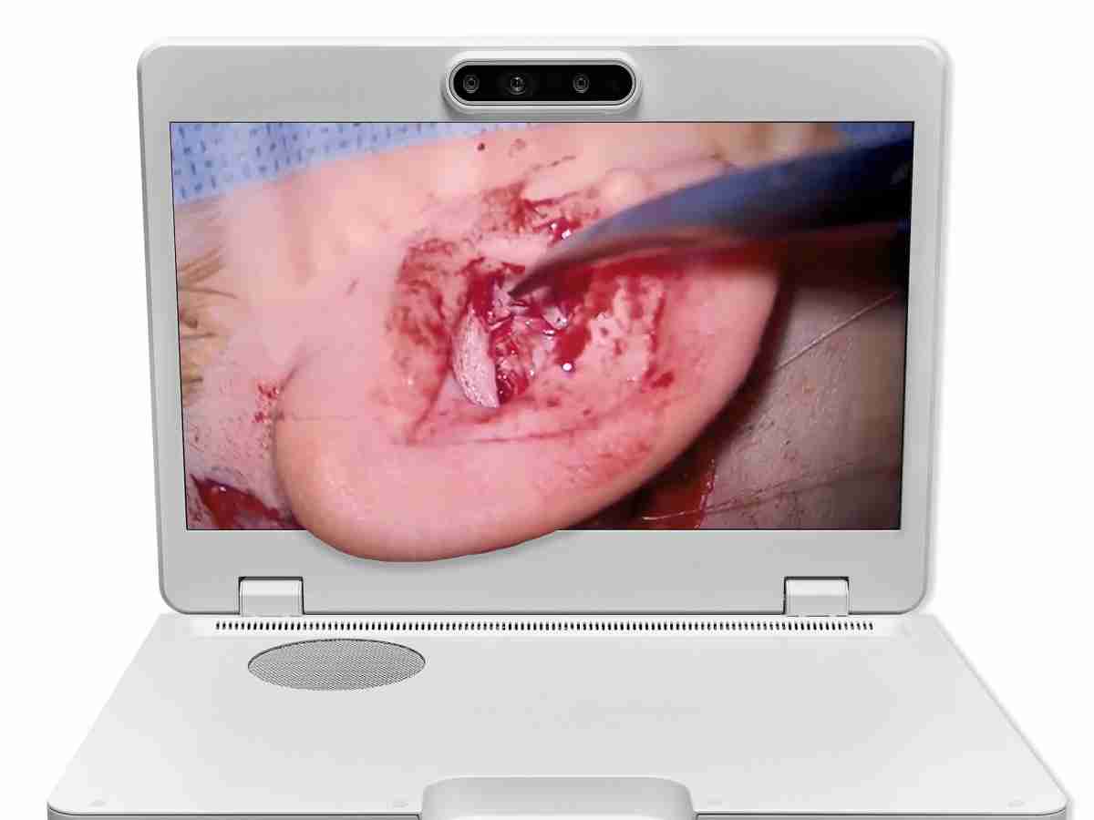 达擎之＂Heads-up 3D显微手术显示系统＂，，，，整合4K裸眼3D显示及眼球追踪系统，，，，具备快速追踪人眼移动位置功能，，减轻医师长时间维持固定姿势的负担，，让医师能有更宽广清晰的3D立体视野及更舒适的姿势来执行手术。。。。